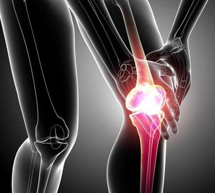 गठिया और आर्थ्रोसिस के साथ घुटने के जोड़ को नुकसान